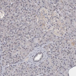MOGAT2 Antibody, Novus Biologicals 0.1mL; Unlabeled:Antibodies, Polyclonal